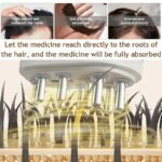 EMS Scalp Essential Oil Massager